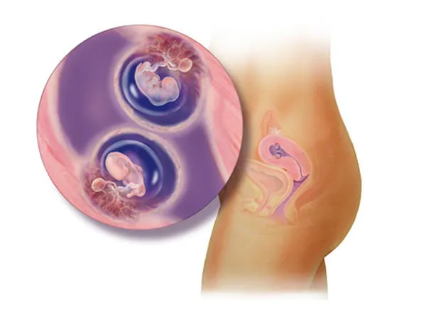 Quá trình phát triển của thai nhi sinh đôi